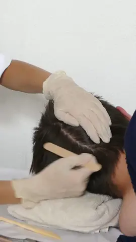 ASMR Scalp Sensory Exam & Dandruff Check | sharp or dull tests, short hair sounds for sleep & relaxation | Medical roleplay on a REAL PERSON #asmrdoctor  #asmr  #asmrsounds  #asmrtiktoks  #asmrmedicalexam  #asmrscalpcheck  #asmrscalpexamination  #asmrtinglesforsleep