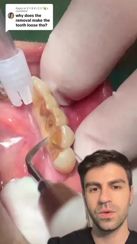 Replying to @S Y B R I C E 🪐 #dentist #teeth #tooth #dentalhygienist 