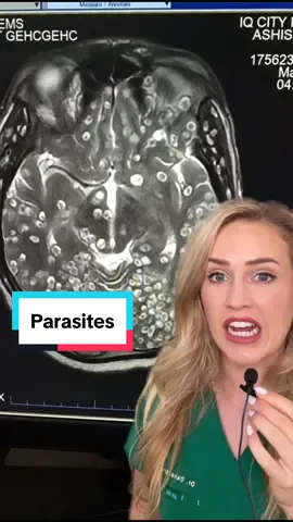 Think twice about eating undercooked meat! Check out this video:  @Ladyspinedoc | Dr. Grunch 🧠 For a more detailed explaination from my fav neurosurgeon!  #parasites #scary #nightmarefuel #meded #medical #doctor 