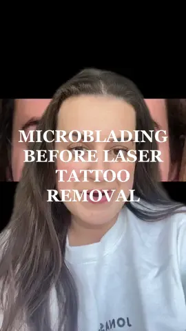 Replying to @user1240381090751 I mentioned in my previous video that I’ve gotten laser tattoo removal many times. But here’s what they looked like before that! #microbladingremoval #microblading #microbladingeyebrows #microbladingbrows #microbladinggonebad #microbladinglaserremoval #microbladinglongterm 