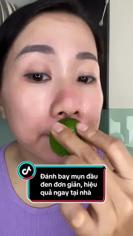 Đánh bay mụn đầu đen đơn giản hiệu quả ngay tại nhà #chamsocda #SkinCare #lamdep #trimun #mundauden #phuonggbeauty 