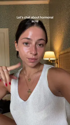 hormonal acne can be a struggle but try to focus in on what works for you and be wary of the excessive info online 💌 #hormones #acnetreatment #skincare #skincaretips #skintok #SkinCare101 #tretinoin 