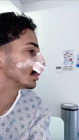 The result 💞.                                           #nosejop  #rhinoplasty 