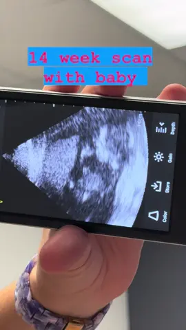 We may only be 14 weeks into this adventure but you’re already so cute waving at the camera and showing off. We’ll see you again in a few weeks for your anatomy scan 💜💜 #meteorologist #WomenInSTEM #WomenOfWx #mymklife #greencountry #tulsa #tulsaok #918 #pregancy #babystember #pregnantlife #pregnant #preggo
