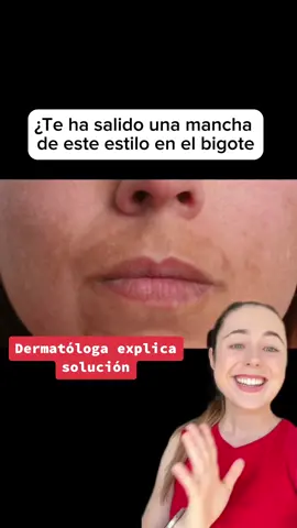 ¿Mancha en el labio superior? ¿Cómo eliminarla? ❤️ #dermatologa #melasma #cloasma #despigmentante #manchasenlapiel #manchasfaciales #dermatologist #melasmatreatment #melasmaskincare #melasmatratamiento #rutinafacial #skincareroutine #skincaretips #cuidadodelapiel #cuidadofacial #dermdoctor #dermatologydoctor #dermatologytiktok #skincareproducts #rutinaskincare #dermatologistrecommended #pielperfecta #pielsinmanchas #pielsana #pielbonita 