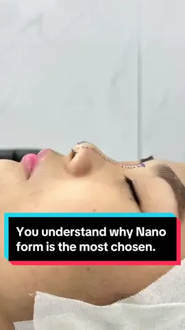 You understand why Nano form is the most chosen. #rhinoplasty #koreasurgery #jisooclinic #plasticsurgery #nosesurgery #nanoform 