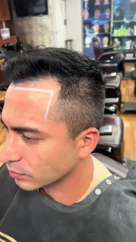 Watch how i restored this guys hairline ✅ #smp #hairtransformation #fyp #hairtattoo #orlandosmp #hairlinetattoo #floridasmp #scalpmicropigmentation #hairlosssolutions #hairlossspecialist #cosmetictattoo #smpartist #hairlosstips #orlandohair #orlandocosmetics 