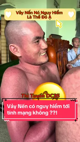 Vẩy nến có Ngu,y Hiểm tới tính mạng không ??? Có nhưng tuỳ từng thể các Bác ạ ... #cứthịninh #cuthininh #thituyendc35 #congchuavaynen #ongbao369 #thituyenxuongkhop 