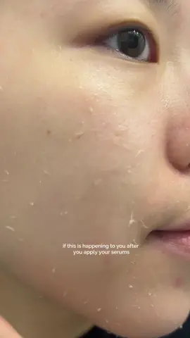 WHY ARE YOUR 🫵 SERUMS PILLING?! #pilling #theordinary #skintok 