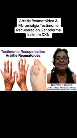 Artritis Reumatoidea & Fibromialgia Testimonio Recuperación con Ganoderma lucidum DXN #Artritis #artritisreumatoide #fibromialgia #dolor #rigidez #deformacion #deformidad #salud #bienestar #suamigoeldoctor #dxn #ganoderma #ganodermalucidum #ganoderma🐣 