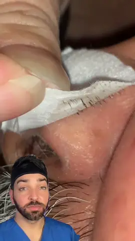 Clear your pores with this hack!