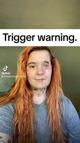 This is the only Justice I will ever get. Just telling you guys what happened to me. #p#ptsdawarenessp#ptsdp#ptsdsurvivord#domesticabuseawareness❤❤❤r#relationshipsd#domesticviolencesurvivorm#MentalHealthAwarenessm#MentalHealths#shootingvictimG#Getout Posting again because it was sensored