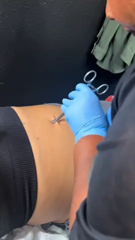 Navel piercing redone over scar tissue ❤️‍🩹✨ . . . . . . #ohboy #piercingstudio #fypシ #fyp #foryoupage #piercing #afrolatina #piercersoftiktok #tattooshoplife #shoppiercer #riversidecaliforina #blackpiercer #piercings #alttoktok 
