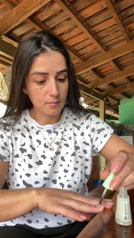 Meu olho ta rocho pq fiz um procedimento estético nas olheiras ☺️