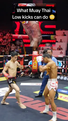 This is what Muay Thai low kicks can do to your leg 😳😬 #muaythai #thaiboxing #painful @RWS Rajadamnern World Series 
