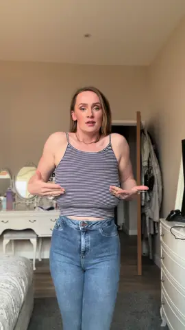 Before and after breast reduction “add yours”  #breastreduction #addyours #transformation #beforeandafter #reduction #reductionsurgery #trending #chestreduction 