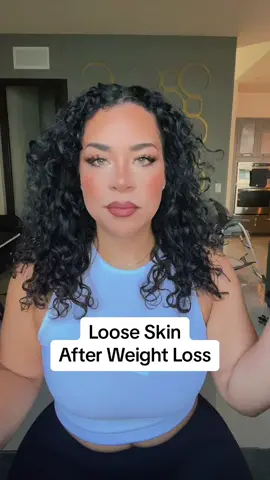 Loose skin after weight loss is a pain, here’s my take on it…. #vsg #vsgcommunity #wls #wlscommunity #bariatriccommunity #fyp #majorweightloss #vsgbabes #weightlosstransformation #pcosvsg 