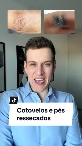 Hoje trouxe pra vocês um vídeo sobre xerose (ressecamento) em cotovelos e pés. Me contem se hidratam bem essas regiões e deem dicas de que tipo de conteúdo querem ver por aqui! 😊 #dermatologist #dermatology #dermato #foryou #fyp #foryoupage #fy #viraltiktok #pelesaudavel #dermatologia #hidratação 