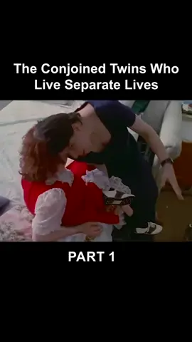 The Conjoined Twins Who Live Separete Lives Part 1 #interview  #truestories  #motivation  #dalyvlog  #viral  #fyp  #foryou  #dalivlog