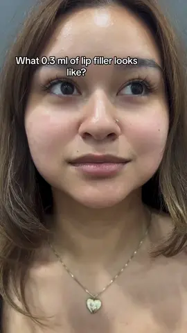 The Perfect Pout! 😍 Achieve a natural plump and juicy lips in just one session! Hurry, grab our exclusive promotion only at Cleo Clinic 💋✨ #lips #lipfiller #lipsfiller #plumplips #juicylips #fy #fyp #fypシ #fypシ゚viral #bibirpink #fillerbibir 