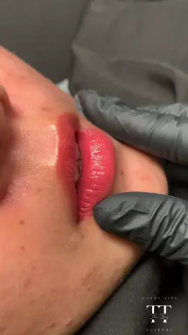 𝐏𝐇𝐔𝐍 𝐌𝐎̂𝐈 CANDYLIPS - 𝐊𝐢̃ 𝐭𝐡𝐮𝐚̣̂𝐭 đ𝐢̉𝐧𝐡 𝐜𝐚𝐨 𝐜𝐡𝐨 𝐦𝐨̂𝐢 đ𝐞̣𝐩 𝐯𝐚̣𝐧 𝐧𝐠𝐮̛𝐨̛̀𝐢 𝐦𝐞̂👄- Khắc phục tình trạng môi thô ráp, xỉn màu chỉ với 30 phút. Sử dụng kim pen giữ màu lên tới 99%- Chăm chút tỉ mỉ từng đường nét để dáng môi cân đối hài hoà với gương mặt- Màu môi mỏng mịn, chuyển tone đậm nhạt hài hoà giúp gương mặt bừng sáng rạng rỡ—————————————————————————🏠 𝑪𝑯𝑨𝑵𝑮 𝑨𝑪𝑨𝑫𝑬𝑴𝒀📱 0396012628 (Zalo, Sms)