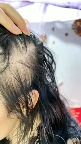 Hair care soap.#fyp #haircare #hairgrowth #need #welldone 