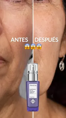 ¡¡¡SÓLO 2 SEMANAS!!! 😳 Un increÍble cambio 🌟 el sérum Lift & Tighten de Anew Platinum ayuda a reafirmar la piel con un efecto lifting que deja los contornos faciales con un aspecto más definido* *Estudio del consumidor con 124 participantes. #sérum #lift&tighten #anew #skincare #avon