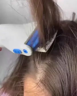 تم توفير جهاز ازالة القمل  #الاصلي ماركة V-COMB. 🐜🐜 جهاز ازاله القمل و القشرة و صبيان 🤦‍♂️ جهاز القمل الكهربائي V-COMB آلة إزالة القمل و.القشرة💥   1-يق تل القمل و الصیبان 2-يق تل البيوض الي تحت البصيلة 3-يسحب القمل والصیبان بلفلتر 4- پسحب حتى قشرة 5-بينشط الدورة الدمويه في الرأس -لو أطفالك يعانوا من القمل والصئبان والحشرات بالرأس الحل جهاز شفط الصئبان والقمل تخلصي من القمل و الصئبان وبكل سرعة . .وسهولة و يسر بدون مواد كيمائية مشط ازالة القمل الامن والفعال كيف بيخلصك مشط ازالة القمل السحري من القمل و حشرات الراس باسرع وقت ✅ -الجهاز بسيط وسهل الاستخدام، بخطوة واحدة وبتمريرة واحدة يمشط و يشفط ويزيل القمل والصئبان صحي ونظيف.💠 الجهاز الأفضل للتخلص من القمل والصئبان ينصح الأطباء وهو عبارة عن جهاز متخصص في علاج القمل والتخلص منه بشكل نهائي،  وهو يعتبر أفضل حل للتخلص من حشرة القمل وبيوضها،  حيث إنه يعمل على الكهرباء ويقوم بالتقاط الحشرات من فروة الشعر، يعتبر الأطباء جهاز V-COMB  أفضل حل لعلاج القمل والتخلص منه نهائياً. إن اختيار الأطباء لم يأتِ عن عبث، حيث إن الجهاز قد برهن أنه الحل الأفضل لعلاج القمل بدون منازع ودون الحاجة  لاستعمال المواد الكيماوية الضارة بالجسم...... مشط كهربائي من شركة لازالة القمل من ‎   وداعأً للقمل والصيبان🌸  #الاصلي السعر 18 الف  🚘 يوجد خدمة توصيل لجميع محافظات العراق ٤ الاف فقط 🚘#الاستخدام #الشعب_الصيني_ماله_حل😂✌️ 
