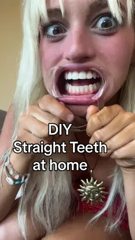 Here goes nothing😬I got this kit from @AlignerCo #retainer #alignerco #straighterteeth #DIY #athome 
