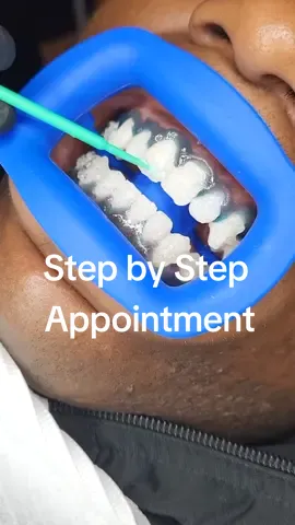 step by step on how the teeth whitening appointment works #torontoteethwhitening #toronto #torontobeauty #torontosmallbusiness #torontolife 