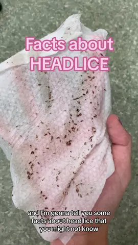 Facts about lice eggs you probably didnt know !!! @Walt pops them under a microscope so we can see whats actually happening!! 