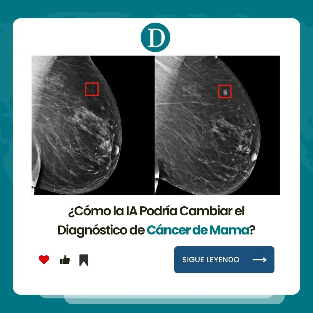 🔍💡 ¡Ahora la  #IA puede detectar el cáncer de mama con anticipación de 5 años!  Un nuevo modelo de aprendizaje profundo puede detectar el cáncer hasta cinco años antes de su desarrollo en mamografías convencionales. Este método tiene el potencial de transformar tratamientos al identificar con precisión al 31% de los pacientes en mayor riesgo ¡Un paso importante en la lucha contra el cáncer! 💪🏼🎗️ #DetecciónDeCáncer #AprendizajeProfundo #Salud #InnovaciónMédica #CáncerDeMama #Sanidad #automatización #Tecnología #ciencia #cancerdemama #chatgpt #viral #parati #fyp 