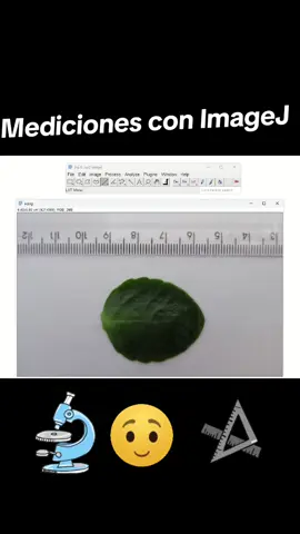 #fun #voz #gamming #inteligenciaartificial #programacion #fyp #imagej #medicina #ingenieria #ia #artificialintelligence #hack 