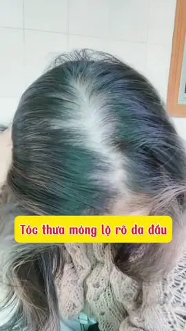 Bí quyết tóc mọc tua tủa chỉ sau 1 liệu trình #maxxhair #rungtoc #moctoc 