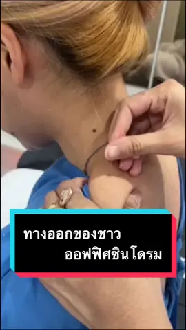 ใครที่ทรมานกับอาการ ปวด คอ บ่า หลังอยู่ เลิกทน แล้วมาฝังเข็มกันค่ะ #ออฟฟิศซินโดรม #ปวดหลัง #ปวดคอบ่าไหล่ #dryneedling #ฝังเข็มรักษาออฟฟิศซินโดรม #ฝังเข็มแก้ปวด #ครอบแก้วรักษาอาการปวด #ครอบแก้ว #tiktokuni #รู้จากtiktok 