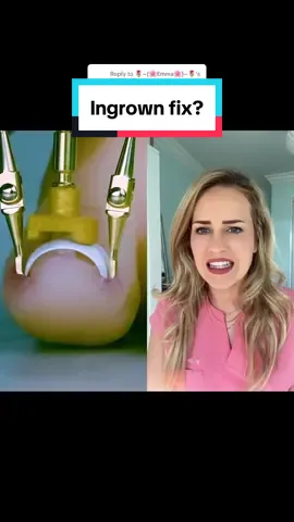 Replying to @🌷~{🌸Emma🌸}~🌷 Put away the medieval torture device! #ingrownnail #ingrowntoenail #ingrowntoenailremoval #ingrownnails #podiatry #surgery #doctor 