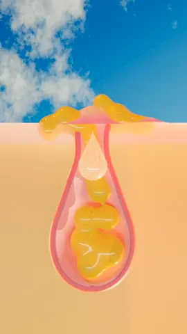 Zit happens, but oil helps 😉  #KraveBeauty #OilLaLa #3danimation #satisfyingvideo #asmrskincare #asmrsounds 