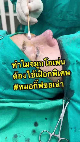 ทำไมเสริมจมูกโอเพ่นถึงแปะเฝือกไม่เหมือนเทคนิคอื่น ฟองน้ำแพ็คจมูกคืออะไรแล้วมีประโยชน์อย่างไร ##หมอกิ๊ฟขอเล่า##nscclinic##หมอกิ๊ฟnsc##จมูกกระดูกซี่โครงตัวเอง##lunarribgraft##ทรงลูน่า