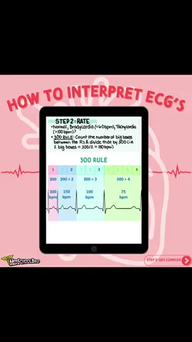 Master ECG Interpretation for your upcoming block, USMLE & licensing exams!  This + so much more in my Cardiology Guide🫀  #fyp #medstudent #medicalschool #usmle #usmlestep1 #medicalstudent 