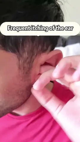 Do you often feel itchy ears?#ear #earwaxcleaning #earwax #earpick #share #goodthing 