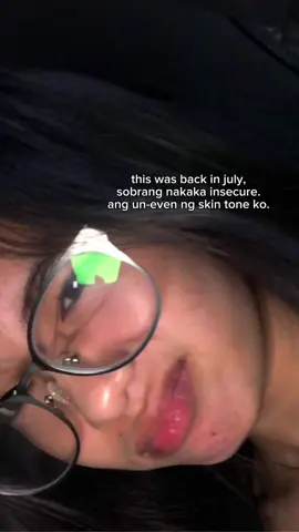 Glow up malala tlga. I don’t wanna gatekeep this no more. Sobrang effective. #skincare #unevenskintone #GlowUp #glowuptips #niacinamidesoap 