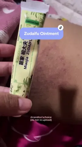 Skin Rashes for my husbands rashes, grabe bilis ng effect 😱 #zudaifuoriginal #zudaifumagicalcream #zudaifuointment #skinrashes #fyp 
