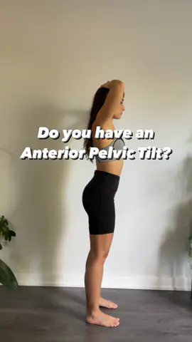 Anterior pelvic tilt is a common postural issue where the pelvis tilts forward, causing an exaggerated curve and strain in the low back.  In this condition, certain muscle groups are tight while others are weak.  Tight muscles often include the hip flexors and lower back muscles, which pull the pelvis forward. Meanwhile, the muscles that are weak or elongated in an anterior pelvic tilt are the hamstrings and the glutes.  Correcting this imbalance typically involves stretching and loosening the tight hip flexors and lower back, along with strengthening the weakened hamstrings and glutes to restore proper pelvic alignment and reduce strain on the lower back. 📢 Find this helpful? Hit the 💾 button to SAVE for later or SHARE 💌 with a friend that you think needs this! Follow @rmt.rachelpantano for more tips!  #posture #posturecorrection #postureexercises #anteriorpelvictilt #lowbackpain #lowbackpainrelief #backpain #backpainrelief