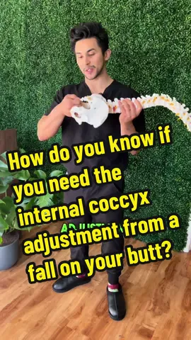 Replying to @user7129740402524 how do you know if you need the internal coccyx adjustment for your tailbone pain from a fall on your butt? #coccyxpain #tailbonepain #coccyx #coccydynia #chiropractic #tailbone 