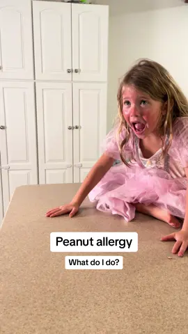Who here is allergic to peanuts? #halloween #momlife #medical #survival #candy