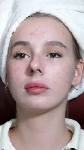#fyp #uodo #noncakeymakeup #smoothbasemakeup #basemakeup #makeuptutorial #makeupbase #foundation #asianmakeup #chinesemakeup #cakeymakeup #fyp #fypシ #foryoupage  #cushionfoundation 