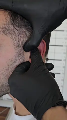 Ear Manipulation #ear #asmr #asmrtiktoks #viraltiktok #duet #duetwithme 