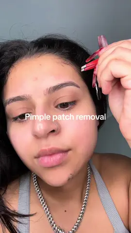 I will buy these over and over again #mightypatch #pimplepatch #heropimplepatch #fyp 