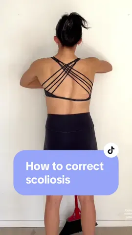 Watch this quick and easy scoliosis correction using a broom! The trick to scoliosis corrections is elongating the spine (naturally reducing the Cobb angle using your muscles). Once we have elongation we want to expand - pulling the broom apart here helps with this. Then we can use expansion breathing to open the concavities.  With consistency its exercises like this which reduce the Cobb angle, stop progression and stop scoliosis pain!  If you want to learn more about your scoliosis and try exercises like this - check out my membership site (link in bio and on my website)  #scoliosisexercise #scoliosiscorrection #scoliosisgirl #scoliosistreatment 