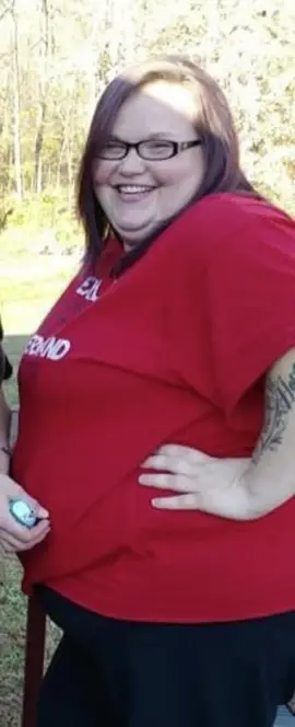 Today marks 1yr out from Bariatric surgery. Thid has 4ever changed my life. Its mental more than anything but i got this. Im down 141 pounds in one year. #fypシ゚viral #bariatricsurgery #bariatriccommunity #livingmybestlife #momwifebosslife 